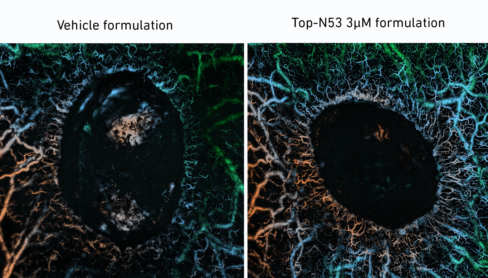 images of wound vessels