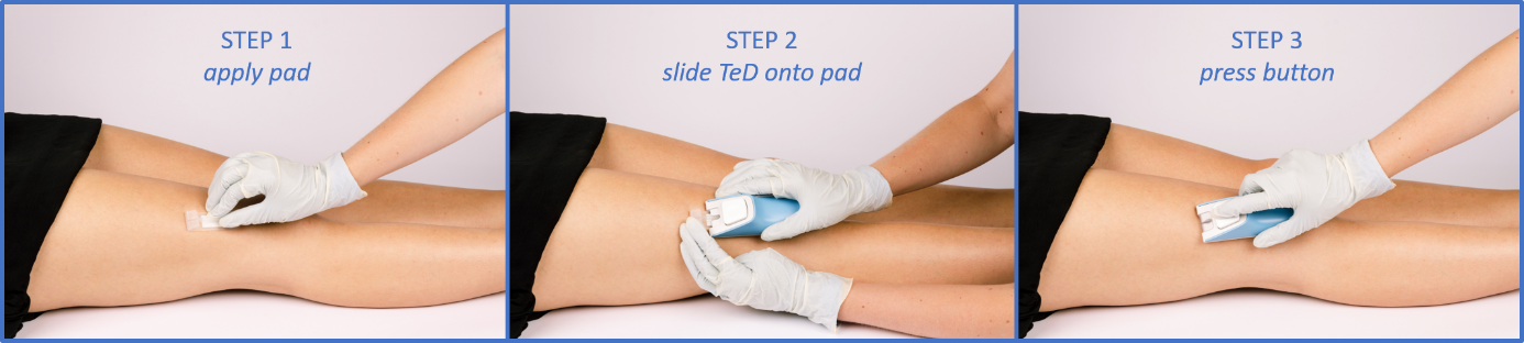 3 steps, to get split skin (pictures by Sonja Frey)