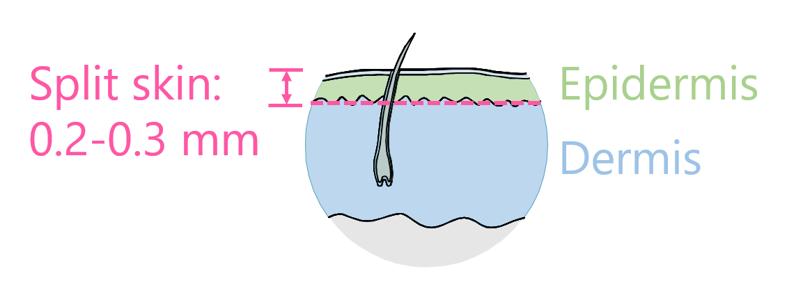 Split skin includes cells from the epidermis and the dermis.